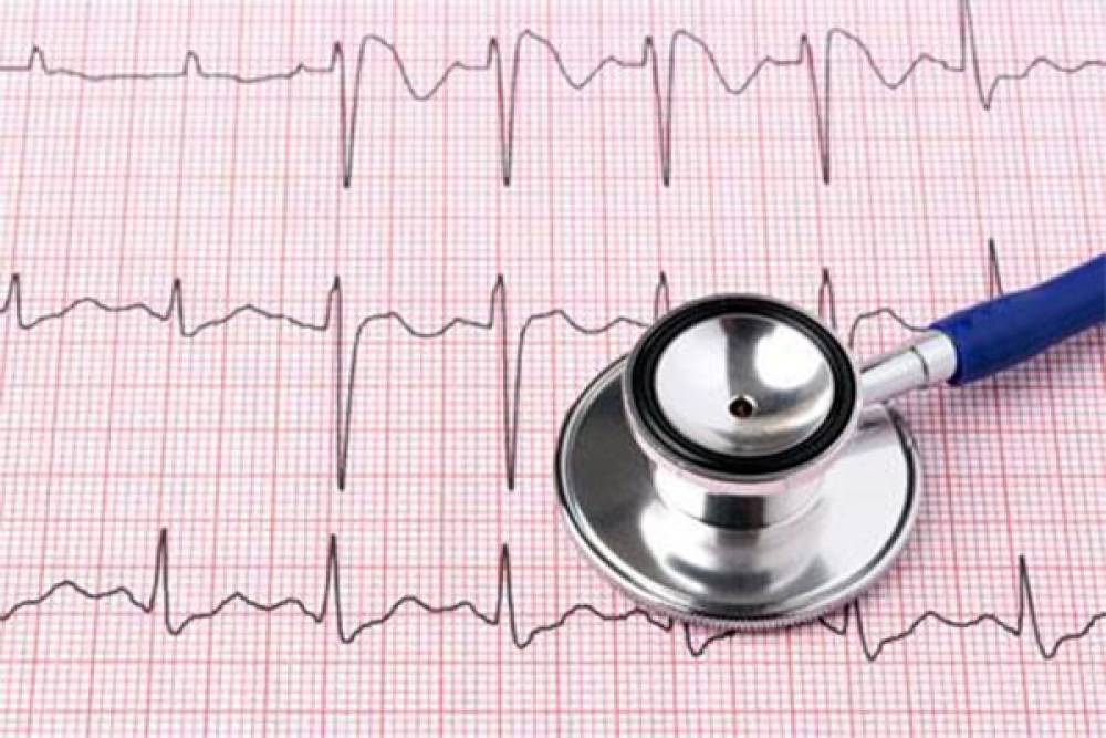 نوار قلب یا EKG چیست؟